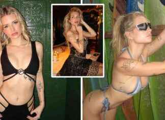 Lottie Moss rushed to hospital after Ozempic overdose: What you need to know news-12092024-202519