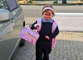 Young Dubliner Achieves Major Milestone in Rare Skin Condition young-dubliner-achieves-major-milestone-in-rare-skin-condition