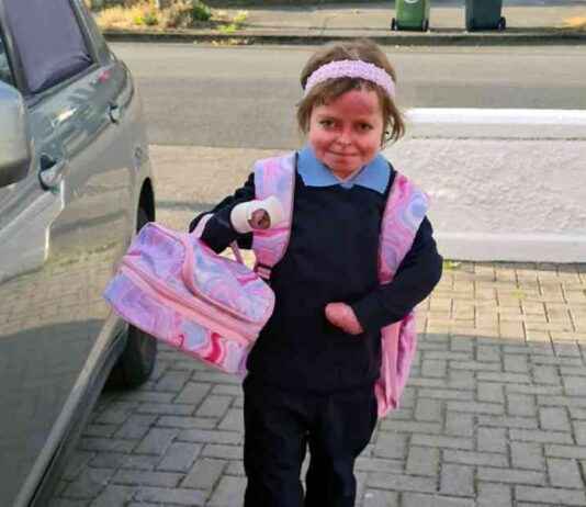 Young Dubliner Achieves Major Milestone in Rare Skin Condition young-dubliner-achieves-major-milestone-in-rare-skin-condition