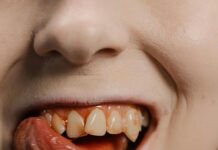 3 Dental Dublin Secrets Revealed: Transform Your Smile Today