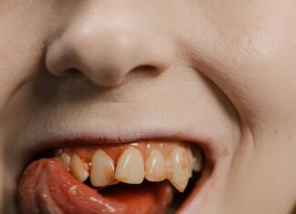 3 Dental Dublin Secrets Revealed: Transform Your Smile Today